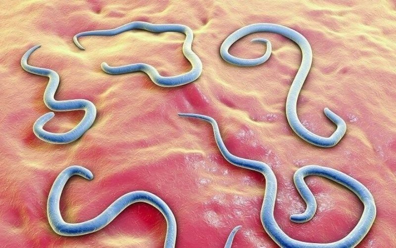 Giun đũa có hình dạng giống như sợi mì spaghetti, màu trắng hoặc vàng nhạt, dài khoảng 5-10cm